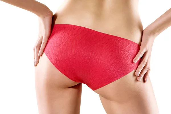 Is alloClae Safe for Hip Dip Correction?