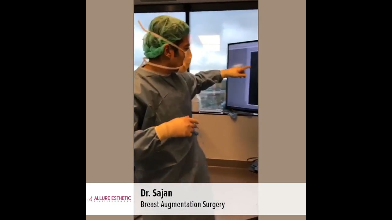 What to Expect Before and During Breast Augmentation Surgery