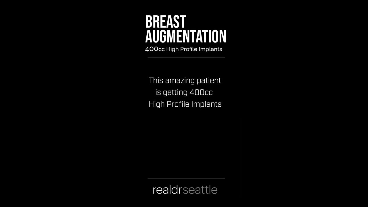 Breast Augmentation