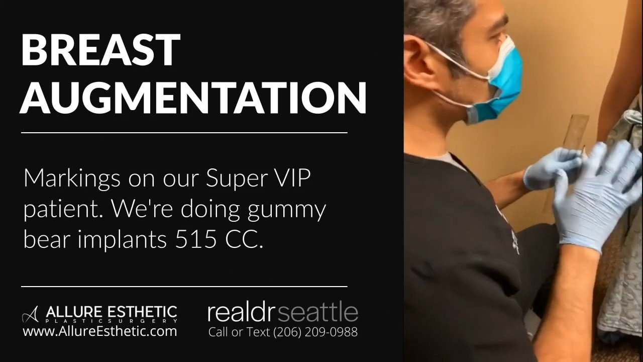 Gummy Bear Implants Seattle  Breast Implants Seattle, WA