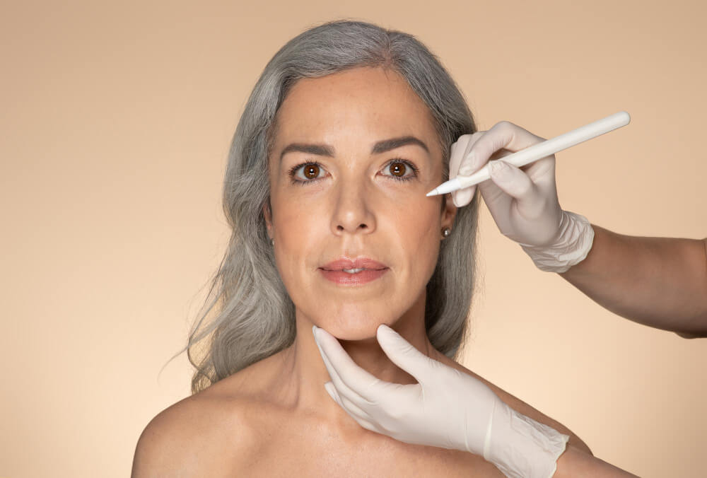 Endoscopic Facelift 02