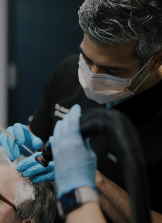 Non Surgical Hair Restoration 01