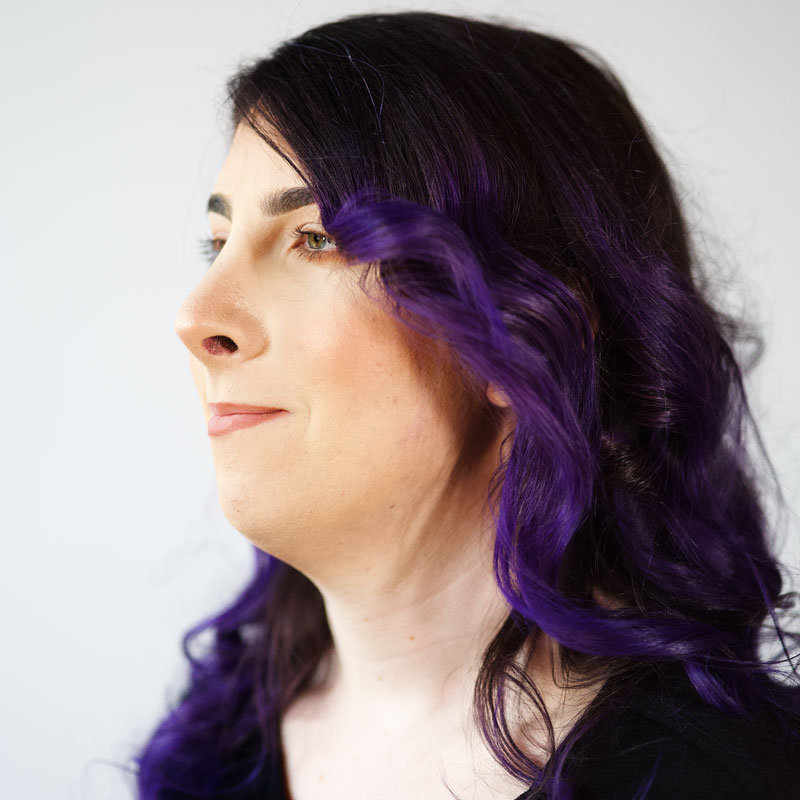 Facial Feminization 09