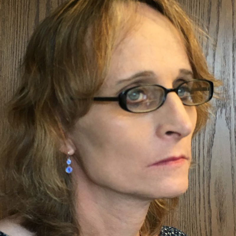 Facial Feminization 03