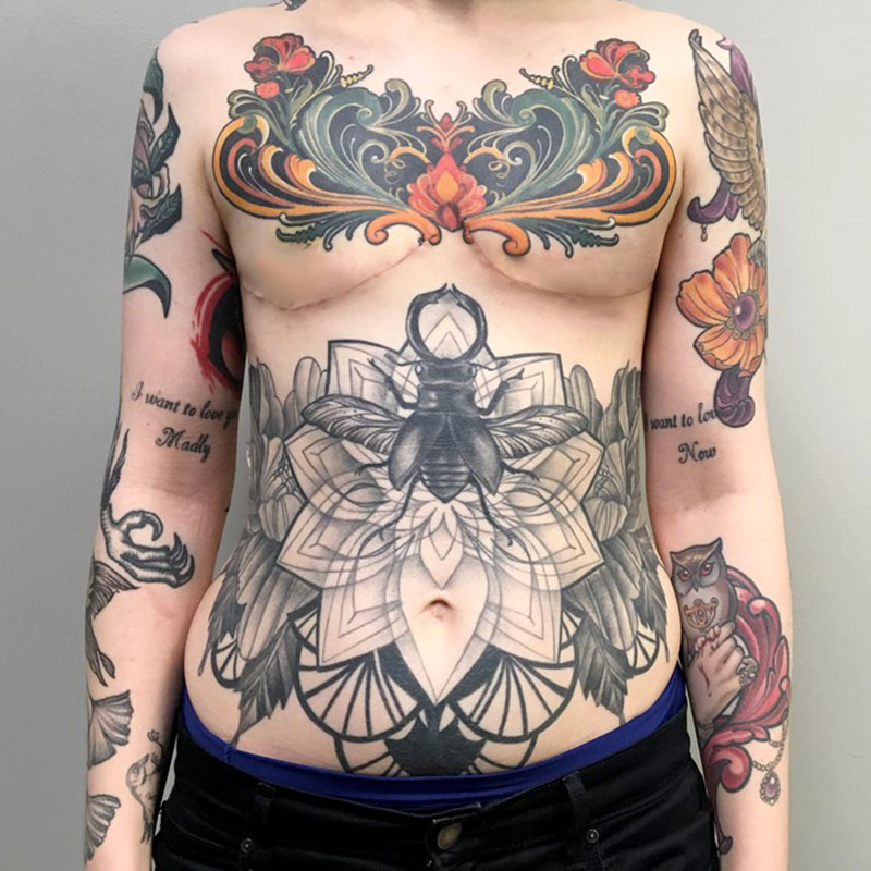 Female To Male Top Surgery 52