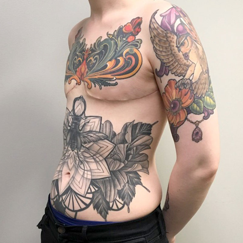 Female To Male Top Surgery 03