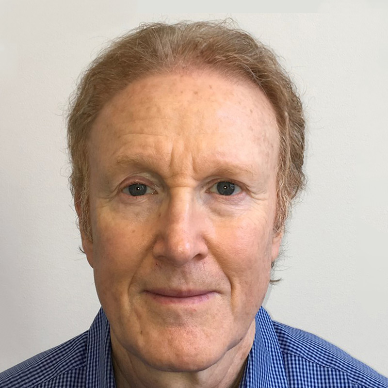 Hair Restoration Removed Photos Deletable 03