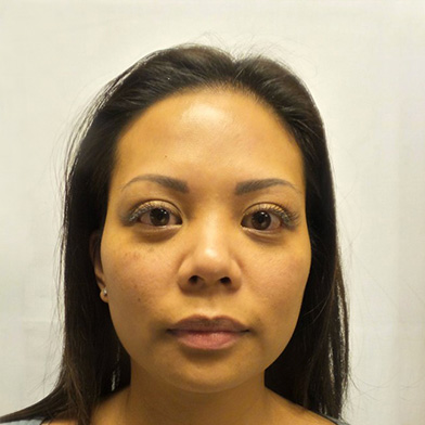 Hair Restoration Removed Photos Deletable 01