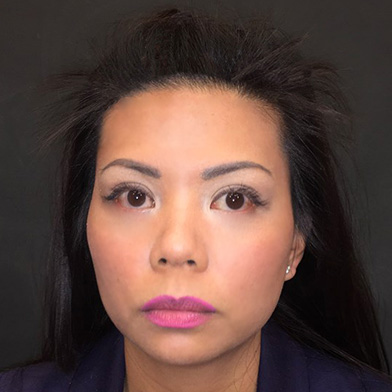 Hair Restoration Removed Photos Deletable 04