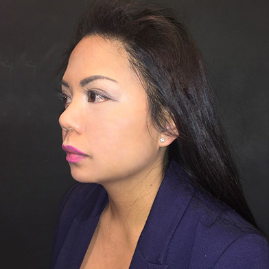 Hair Restoration Removed Photos Deletable 05