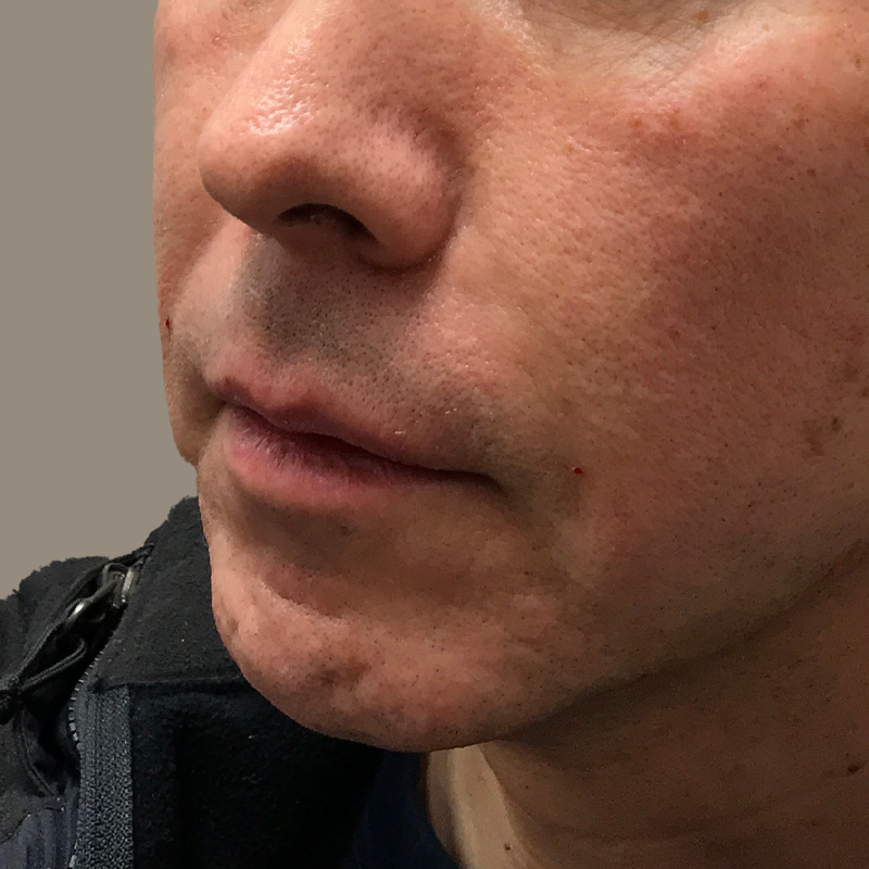 Injectables And Fillers 09