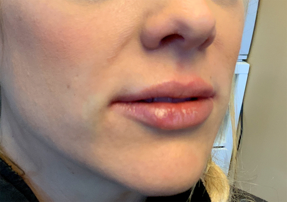 Injectables And Fillers 03