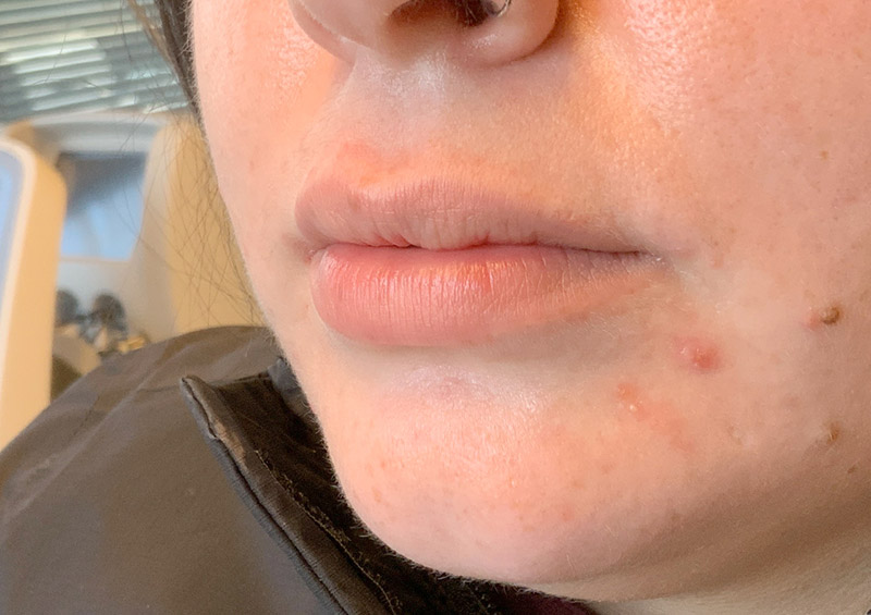 Injectables And Fillers 03