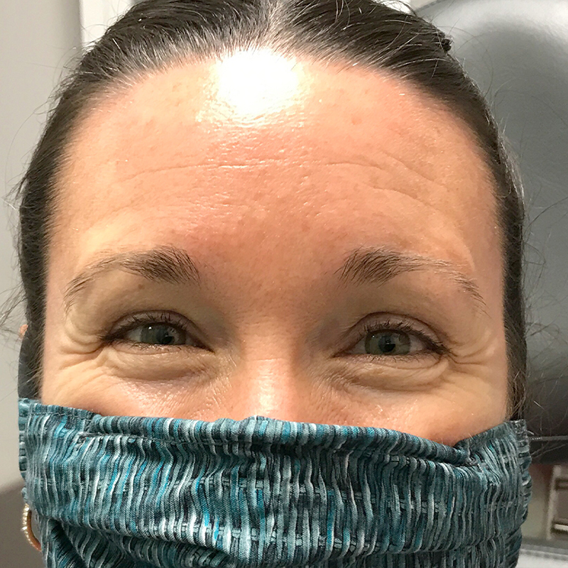 Injectables And Fillers 109