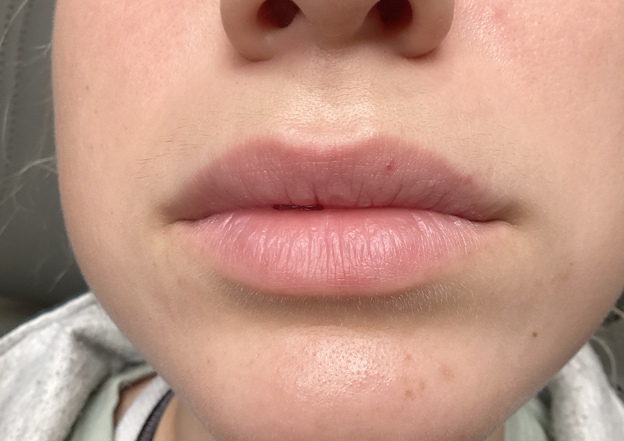 Injectables And Fillers 01