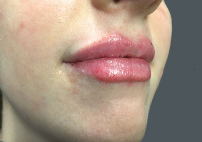 Injectables And Fillers 03