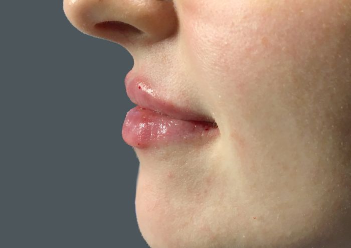 Injectables And Fillers 05