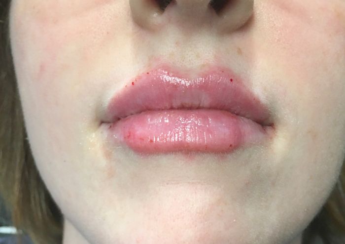 Injectables And Fillers 09