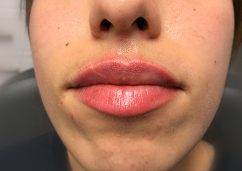 Injectables And Fillers 137