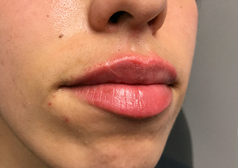 Injectables And Fillers 05