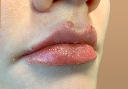 Injectables And Fillers 03