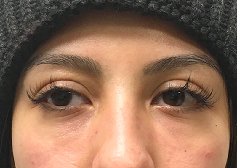 Injectables And Fillers 140