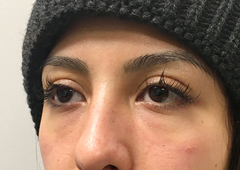 Injectables And Fillers 03