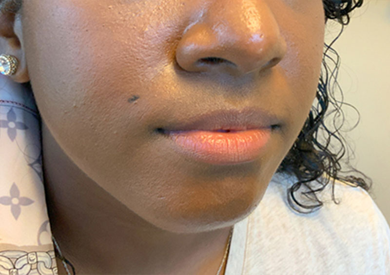 Injectables And Fillers 05