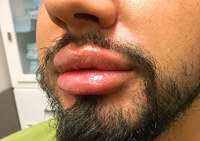 Injectables And Fillers 03