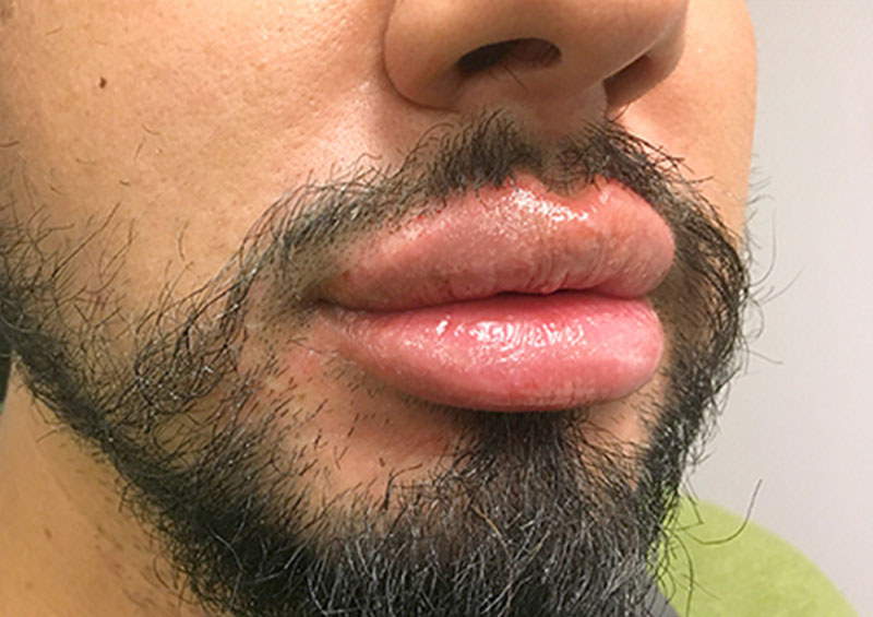 Injectables And Fillers 05