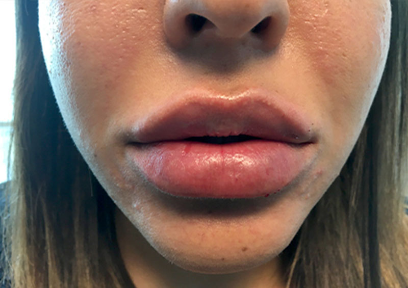 Injectables And Fillers 145