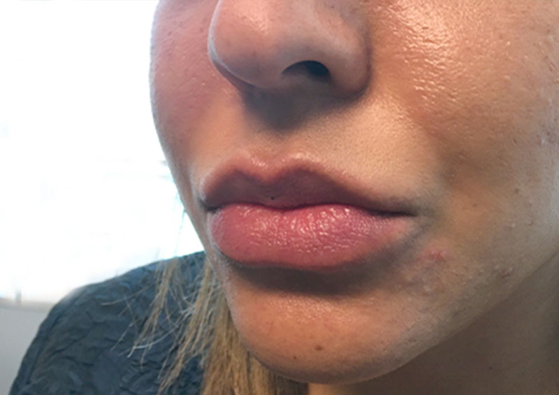 Injectables And Fillers 03