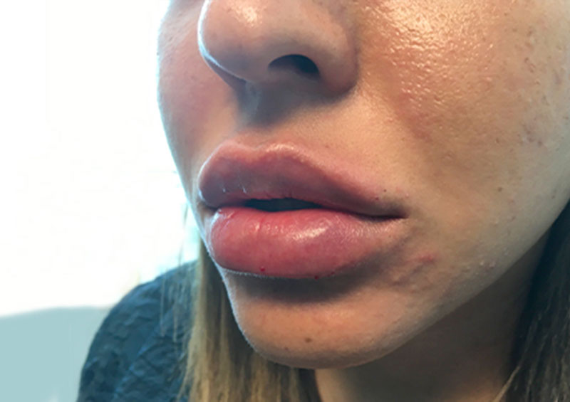 Injectables And Fillers 03