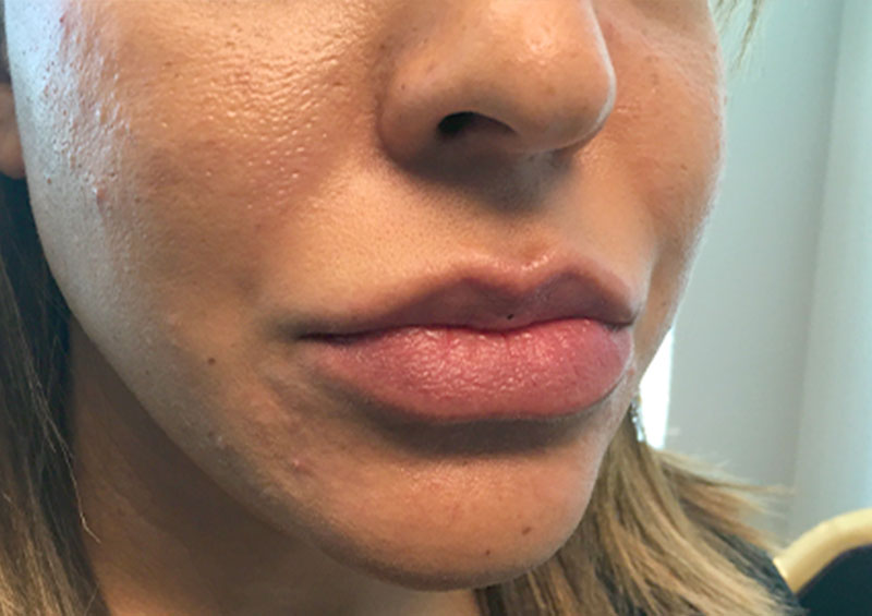 Injectables And Fillers 05