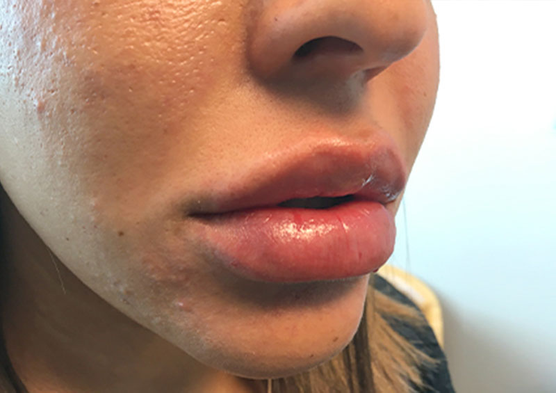 Injectables And Fillers 05