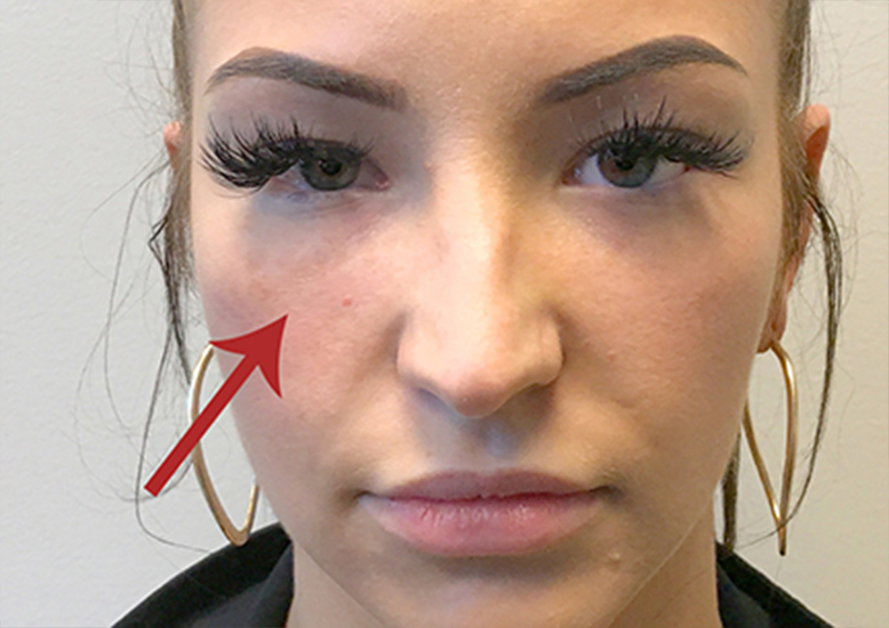 Injectables And Fillers 148