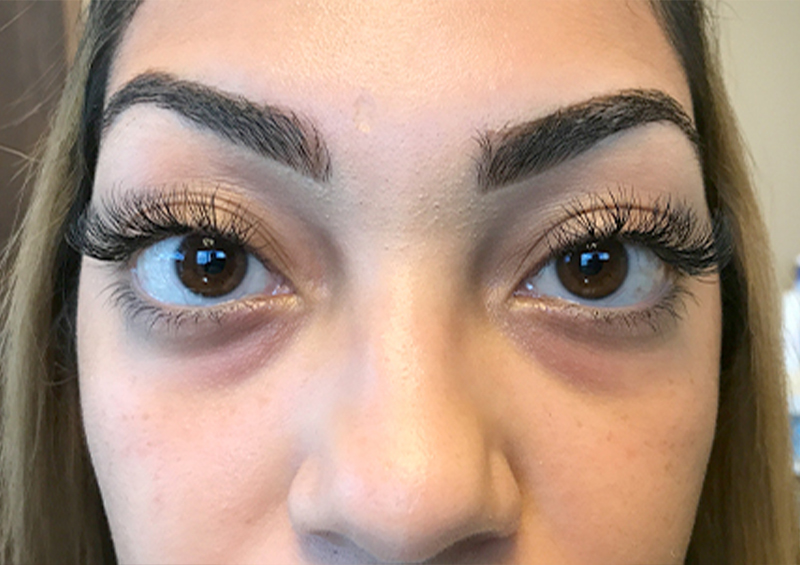 Injectables And Fillers 01