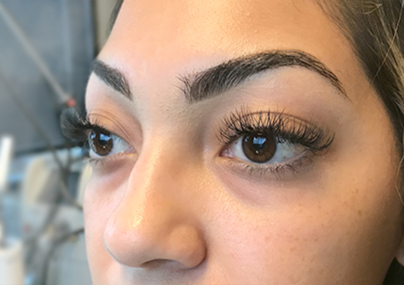 Injectables And Fillers 03