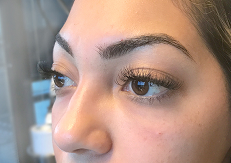 Injectables And Fillers 03