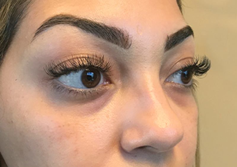 Injectables And Fillers 05