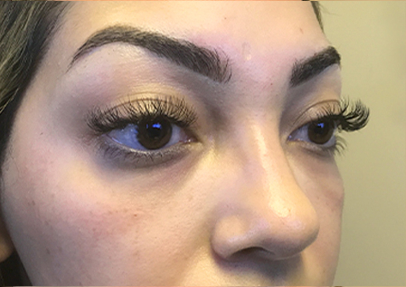 Injectables And Fillers 05