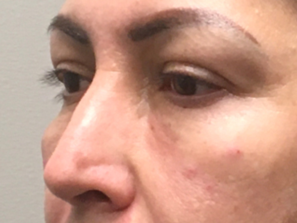 Injectables And Fillers 03