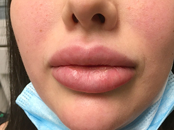 Injectables And Fillers 01