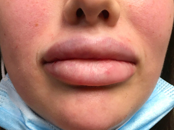 Injectables And Fillers 155