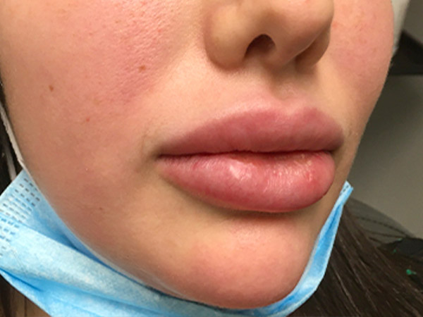 Injectables And Fillers 03