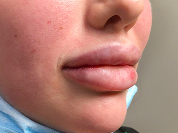 Injectables And Fillers 03