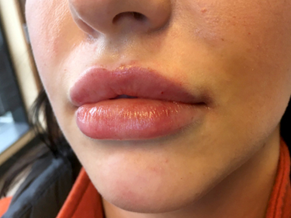 Injectables And Fillers 05