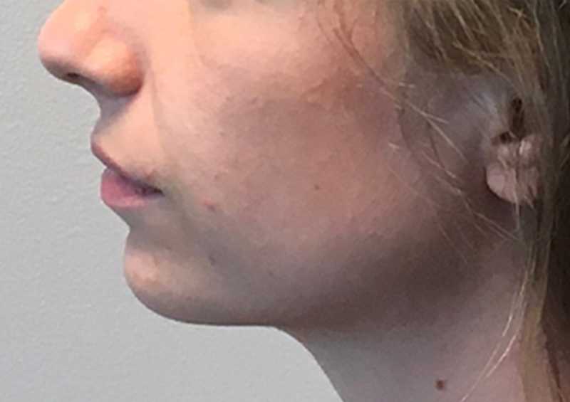 Injectables And Fillers 05