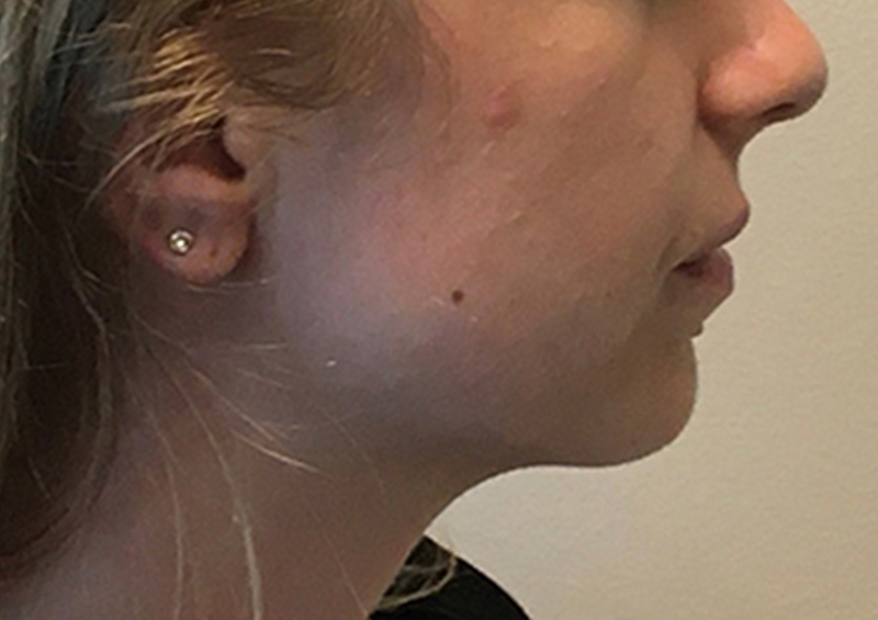 Injectables And Fillers 07