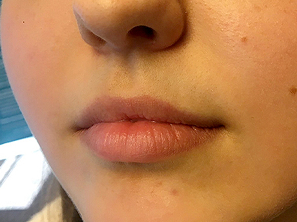 Injectables And Fillers 03